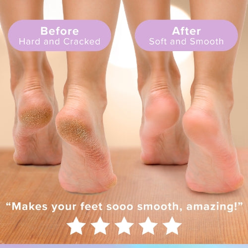 Glowxie Salicylic Acid Reviving Foot Cream
