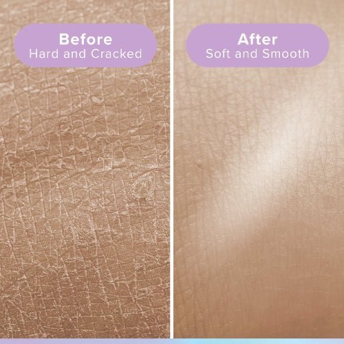 Glowxie Exfoliating Mitt for Body (3-Pack)