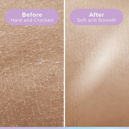 Glowxie Exfoliating Mitt for Body (3-Pack)