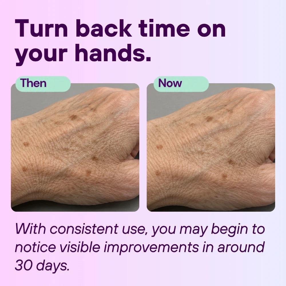 Hand Renewal Cream