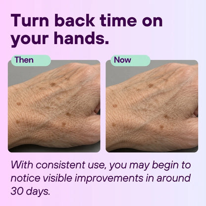 Hand Renewal Cream