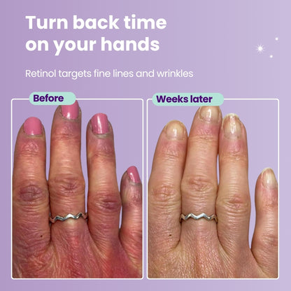 Glowxie Retinol Hand Cream